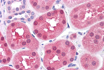 DBT Rabbit Polyclonal Antibody