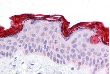 DBT Rabbit Polyclonal Antibody