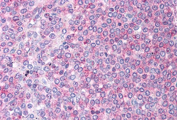 DBT Rabbit Polyclonal Antibody