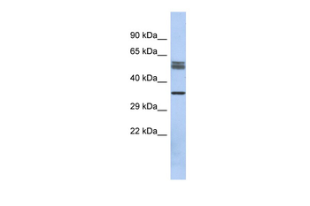 DBT Rabbit Polyclonal Antibody