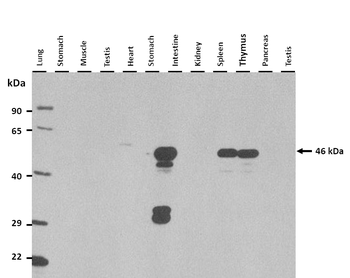 Dusp7 Rabbit Polyclonal Antibody