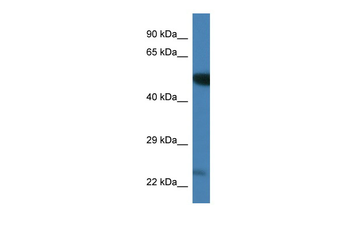 Plk3 Rabbit Polyclonal Antibody