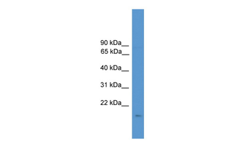 CSN3 Rabbit Polyclonal Antibody