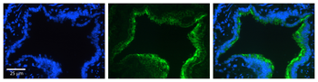 CTTN Rabbit Polyclonal Antibody