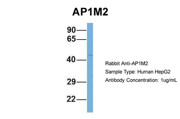 AP1M2 Rabbit Polyclonal Antibody