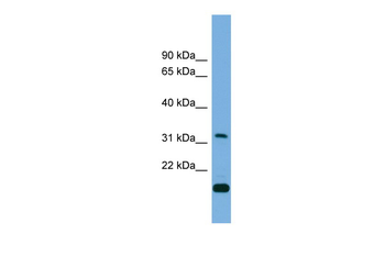 CTDSP2 Rabbit Polyclonal Antibody