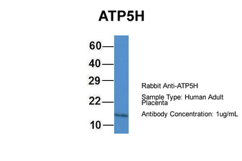 ATP5PD Rabbit Polyclonal Antibody
