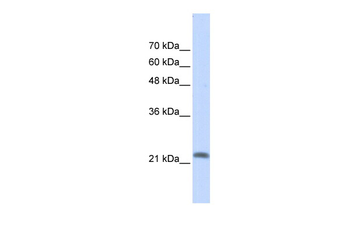RASL10A Rabbit Polyclonal Antibody