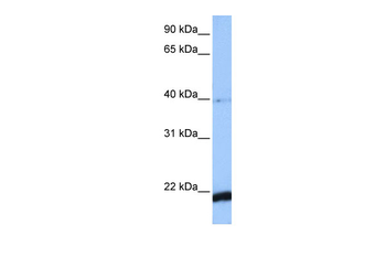 HBS1L Rabbit Polyclonal Antibody