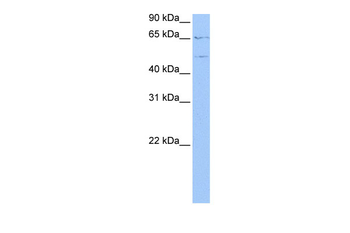 WASF3 Rabbit Polyclonal Antibody