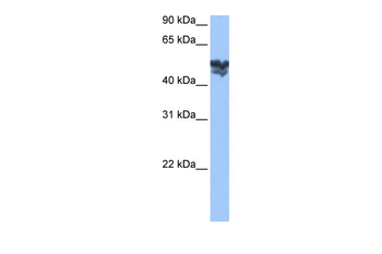 WASF3 Rabbit Polyclonal Antibody