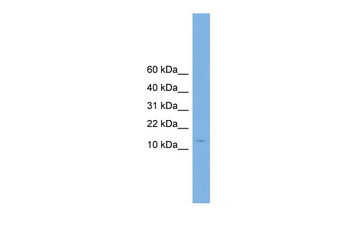 CPLX2 Rabbit Polyclonal Antibody
