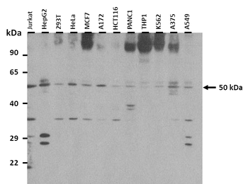 FGL2 Rabbit Polyclonal Antibody