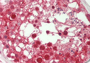 SPIN1 Rabbit Polyclonal Antibody