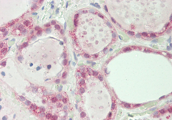 SPIN1 Rabbit Polyclonal Antibody