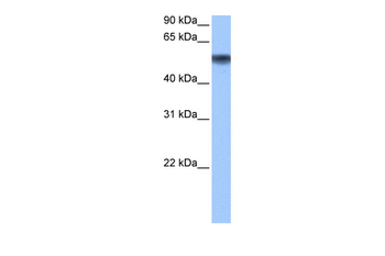 METAP2 Rabbit Polyclonal Antibody