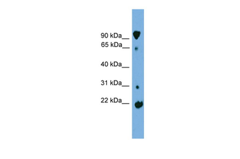 KLHL2 Rabbit Polyclonal Antibody