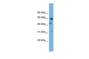 PNKP Rabbit Polyclonal Antibody