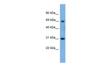 PNKP Rabbit Polyclonal Antibody