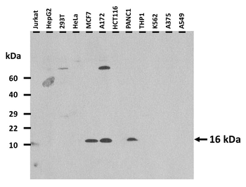 PSORS1C1 Rabbit Polyclonal Antibody