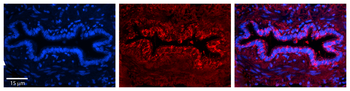 PRDX3 Rabbit Polyclonal Antibody