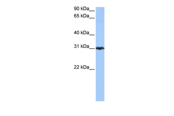 PRDX3 Rabbit Polyclonal Antibody