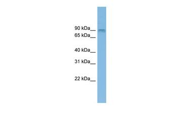 CENTG1 Rabbit Polyclonal Antibody