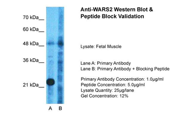 WARS2 Rabbit Polyclonal Antibody