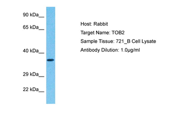 TOB2 Rabbit Polyclonal Antibody