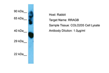 RRAGB Rabbit Polyclonal Antibody