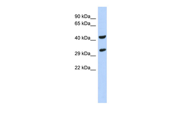 ASB8 Rabbit Polyclonal Antibody