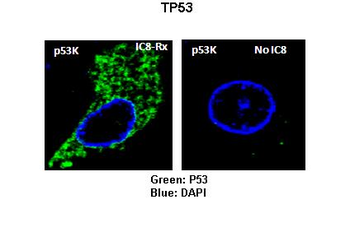 TP53RK Rabbit Polyclonal Antibody