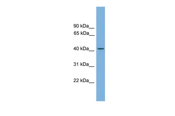 LRG1 Rabbit Polyclonal Antibody