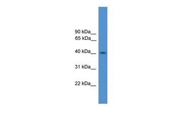 KLHDC3 Rabbit Polyclonal Antibody