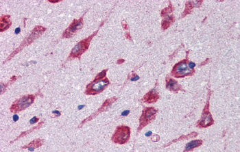 CBLN4 Rabbit Polyclonal Antibody