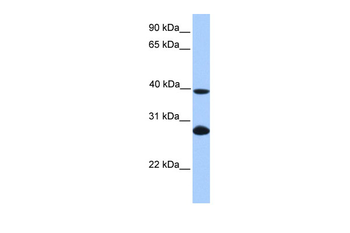 UBE2F Rabbit Polyclonal Antibody