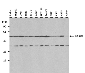 NEU4 Rabbit Polyclonal Antibody