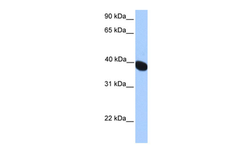 NEURL2 Rabbit Polyclonal Antibody