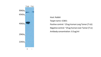 CCBE1 Rabbit Polyclonal Antibody