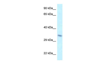 Taf8 Rabbit Polyclonal Antibody