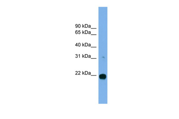 MITD1 Rabbit Polyclonal Antibody