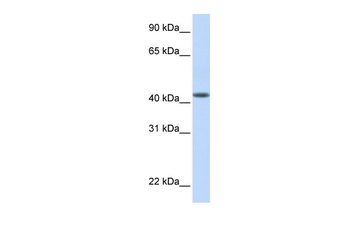DENND1B Rabbit Polyclonal Antibody
