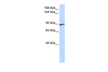 SPATA5 Rabbit Polyclonal Antibody