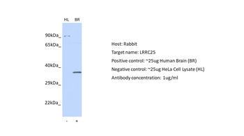LRRC25 Rabbit Polyclonal Antibody