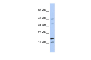 WFDC5 Rabbit Polyclonal Antibody