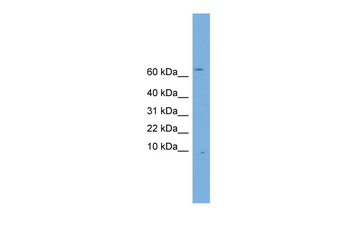 OTOS Rabbit Polyclonal Antibody