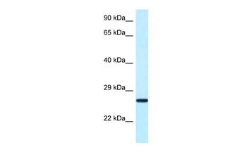 Nudt16 Rabbit Polyclonal Antibody