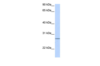 GRPEL2 Rabbit Polyclonal Antibody