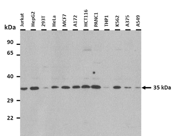HORMAD2 Rabbit Polyclonal Antibody