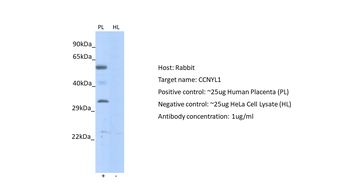 CCNYL1 Rabbit Polyclonal Antibody